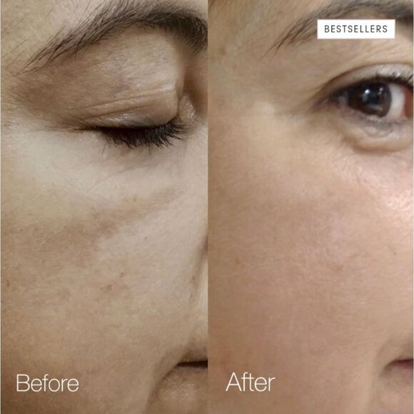 Skin inc daily dose of vitamin abc+ - Picture 4 of 12